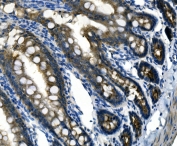 Desmoglein 2 Antibody Rat Intestine IHC. Immunohistochemistry analysis of FFPE rat intestine tissue stained with Desmoglein 2 antibody detecting DSG2. Epithelial cells lining intestinal glands and luminal surfaces show membranous and cytoplasmic staining with clear localization at cell-cell junctions, consistent with DSG2 presence in desmosomal adhesion complexes that maintain epithelial cohesion and structural integrity. Surrounding stromal tissue shows reduced staining. Hematoxylin counterstain highlights nuclei in blue. HIER: boil tissue sections in pH 8 EDTA buffer for 20 min and allow to cool before testing.