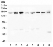 Desmoglein 2 Antibody Multi-Sample WB. Western blot analysis of human and rodent lysates using Desmoglein 2 antibody detecting DSG2. Lane 1: K562, Lane 2: HeLa, Lane 3: HepG2, Lane 4: A549, Lane 5: Caco-2, Lane 6: SW620, Lane 7: rat liver, Lane 8: mouse liver. A band is detected at approximately 130-160 kDa across multiple samples, consistent with the predicted molecular weight of Desmoglein 2, with variation reflecting glycosylation of this transmembrane desmosomal cadherin. The broad detection pattern across epithelial-derived cell lines and tissues supports DSG2 expression as a key component of desmosomal adhesion complexes involved in maintaining cell-cell junction integrity.