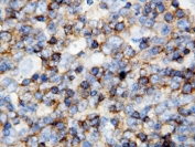 IHC-P: anti-CD45 antibody testing of human tonsil tissue