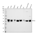 HDJ2 Antibody by WB in human, mouse and rat lysates. Western blot analysis using HDJ2 Antibody at 0.5 ug/ml. Lane 1: HeLa; lane 2: A549; lane 3: HepG2; lane 4: SiHa; lane 5: rat brain; lane 6: C6; lane 7: mouse brain; lane 8: Neuro-2a. Samples were separated by 10% SDS-PAGE under reducing conditions, with 30 ug loaded per lane. Immunoreactive bands are detected around 40â45 kDa, consistent with the expected 45 kDa molecular weight of DNAJA1. Several samples display closely spaced bands, while the C6 signal is comparatively weak. This DNAJA1 Polyclonal Antibody detects the HSP40 co-chaperone HDJ2 across the tested human and rodent samples.