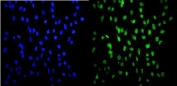 Immunofluorescent staining of FFPE human U-2 OS cells with HSF2 antibody (green) and DAPI nuclear stain (blue). HIER: steam section in pH6 citrate buffer for 20 min.