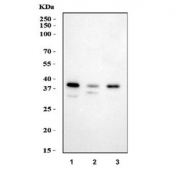 HSD17B1 Antibody Multi-Species WB. Western blot analysis of human T-47D, human 293T, and rat C6 cell lysates using HSD17B1 Antibody demonstrates a prominent immunoreactive band at approximately 35 kDa, consistent with the predicted molecular weight of Hydroxysteroid 17-Beta Dehydrogenase 1 (HSD17B1). HSD17B1 is a steroidogenic enzyme that catalyzes the conversion of estrone to biologically active estradiol and plays a central role in estrogen biosynthesis and steroid hormone metabolism. Comparable band detection across human and rat cell lysates supports recognition of HSD17B1 in multiple species. Minor lower molecular weight bands are observed in the 293T lysate and may represent degradation products, alternatively processed forms, or non-specific antibody reactivity.