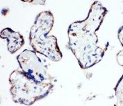 HSD17B1 Antibody Human Placenta IHC. Immunohistochemistry staining of FFPE human placenta tissue using HSD17B1 Antibody demonstrates distinct membranous and cytoplasmic HRP-DAB brown staining within trophoblastic cell populations lining placental villous structures. The staining pattern is consistent with expression of Hydroxysteroid 17-Beta Dehydrogenase 1 (HSD17B1), a steroidogenic enzyme that catalyzes the conversion of estrone to biologically active estradiol and plays a key role in estrogen biosynthesis during pregnancy. Prominent placental staining is consistent with the established involvement of HSD17B1 in steroid hormone metabolism, endocrine regulation, and maintenance of reproductive tissue function. Required HIER: steam tissue sections in pH 6 citrate buffer for 20 minutes before testing.
