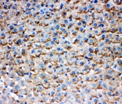 HSD17B1 Antibody Rat Liver IHC. Immunohistochemistry staining of FFPE rat liver tissue using HSD17B1 Antibody demonstrates widespread granular cytoplasmic HRP-DAB brown staining throughout hepatocyte populations. The staining pattern is consistent with expression of Hydroxysteroid 17-Beta Dehydrogenase 1 (HSD17B1), a steroidogenic enzyme involved in estrogen biosynthesis and steroid hormone metabolism. Prominent hepatic staining is consistent with the important role of the liver in steroid hormone processing, metabolic regulation, and maintenance of endocrine homeostasis. Required HIER: steam tissue sections in pH 6 citrate buffer for 20 minutes before testing.