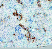 Immunohistochemical staining using TIM-1 antibody on FFPE rat kidney tissue sections. Heat-induced epitope retrieval was performed using EDTA buffer (pH 8.0) prior to antibody incubation. TIM-1 antibody shows strong membranous and cytoplasmic staining in renal tubular epithelial cells, consistent with expression of T cell immunoglobulin and mucin domain-containing protein 1 in kidney tissue. Detection was performed using an HRP-conjugated secondary antibody with DAB as the chromogen, and nuclei were counterstained with hematoxylin.