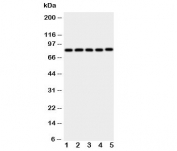 Ku80 Antibody WB. Western blot analysis of human cell lysates using Ku80 antibody. Lane 1: Jurkat cell lysate, Lane 2: CEM cell lysate, Lane 3: Raji cell lysate, Lane 4: COLO320 cell lysate, Lane 5: HT1080 cell lysate. A band is detected at approximately 80-86 kDa, consistent with the predicted molecular weight of Ku80 (XRCC5). The consistent band intensity across multiple hematopoietic and cancer-derived cell lines reflects the widespread expression of Ku80 and aligns with its role as a nuclear DNA damage response protein involved in double-strand break repair signaling.