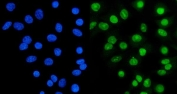 Ku70 Antibody A549 Cell IF. Immunofluorescent staining of FFPE human A549 cells with Ku70 antibody (green) and DAPI nuclear stain (blue). HIER: steam section in pH6 citrate buffer for 20 min.