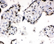 Ku70 Antibody Placenta Immunohistochemistry. IHC-P: Ku70 antibody testing of human placenta tissue. HIER: steam section in pH6 citrate buffer for 20 min.