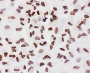 Ku70 Antibody A549 Cell ICC. Immunocytochemistry testing of FFPE human A549 cells. HIER: steam section in pH6 citrate buffer for 20 min.