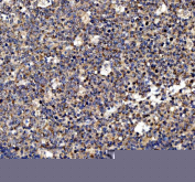 Immunohistochemistry analysis of MYD88 expression in human tonsil tissue. Paraffin-embedded human tonsil sections were subjected to heat-mediated antigen retrieval in EDTA buffer (pH 8.0) and incubated with anti-MYD88 antibody, followed by HRP-conjugated secondary antibody and DAB chromogen development. Brown immunoreactivity is observed predominantly in lymphoid cells, consistent with cytoplasmic MYD88 expression in immune cell populations, with hematoxylin nuclear counterstain (blue).