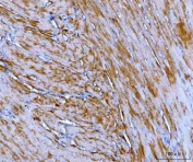 IHC staining of FFPE rat heart tissue with NDUFA1 antibody. HIER: boil tissue sections in pH8 EDTA for 20 min and allow to cool before testing.