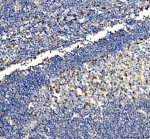 NLRP3 Antibody Human Tonsil IHC. Immunohistochemical staining of FFPE human tonsil tissue using NLRP3 Antibody / Inflammasome Marker. Heat-induced epitope retrieval was performed in pH 8.0 EDTA buffer before incubation with rabbit anti-NLRP3 antibody at 2 ug/ml. An HRP-conjugated goat anti-rabbit secondary antibody with DAB chromogen was used for visualization. NLRP3 staining is observed predominantly in scattered immune cells within the tonsil, consistent with its established expression in cells of the innate immune system and its role in inflammasome activation. This NLRP3 Antibody, an Inflammasome Marker, is suitable for investigating innate immunity, inflammatory signaling, and inflammasome biology.