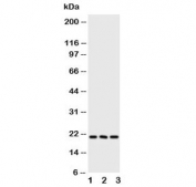 FGF21 Antibody Human Mouse WB. Western blot testing of FGF21 antibody and Lane 1:  human A549;  2: human A431;  3: mouse HEPA cell lysate. Predicted molecular weight ~21 kDa.