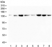 Western blot testing of human 1) HeLa, 2) Jurkat, 3) HEK293, 4) COS-7 (monkey), 5) Raji, 6) K562, 7) Caco-2 and 8) HepG2 lysate with Myosin Phosphatase antibody.  Expected molecular weight: 110~130 kDa.