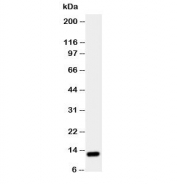 TFF1 Antibody for Rat. Western blot analysis of rat stomach tissue lysate using TFF1 Antibody for Rat. Lane 1: rat stomach lysate. A band is detected at approximately 12 kDa, consistent with the predicted molecular weight of Trefoil factor 1 (TFF1). The detected band corresponds to the small secreted trefoil peptide expressed in gastric mucosal epithelium, aligning with the known enrichment of TFF1 in rat stomach tissue where it contributes to mucosal protection and epithelial repair.