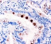 TFF1 Antibody for Rat. Immunohistochemical analysis of Trefoil factor 1 (TFF1) in rat intestine tissue using TFF1 Antibody for Rat. Tissue sections show HRP-DAB brown cytoplasmic staining in epithelial cells lining intestinal glandular structures, while surrounding stromal components remain largely negative. Hematoxylin counterstain highlights nuclei (blue). The observed epithelial staining pattern is consistent with expression of the secreted trefoil peptide TFF1 in mucosal epithelial cells involved in gastrointestinal barrier protection and epithelial repair.
