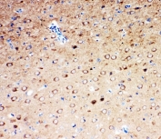 Serotonin Transporter Antibody Rat Brain IHC. Immunohistochemistry testing of Serotonin transporter antibody and rat brain tissue.