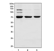 Western blot analysis using PAK6 antibody. Lane 1: human Caco-2 whole cell lysates; Lane 2: rat brain tissue lysates; Lane 3: mouse brain tissue lysates. The predicted molecular weight of p21-activated kinase 6 is ~75 kDa, and a predominant band is observed at ~70 kDa, consistent with the commonly observed apparent molecular weight of PAK6. Additional higher-molecular-weight bands around ~100 kDa and ~140 kDa are also observed, which may reflect higher-order or modified PAK6 species in certain samples.