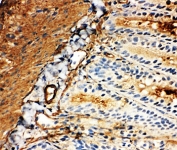 GLUT5 Antibody Rat Intestine IHC. Immunohistochemical staining of frozen rat intestine demonstrates GLUT5 expression using a GLUT5 antibody. GLUT5, also known as Fructose Transporter Protein, is a facilitative transporter responsible for the absorption of dietary fructose and plays a central role in carbohydrate metabolism. Strong membranous and apical staining is observed in intestinal epithelial cells, consistent with the known localization of GLUT5 in enterocytes of the small intestine. These findings highlight the importance of GLUT5 in mediating fructose uptake from the intestinal lumen. The results support the utility of GLUT5 Antibody for studies of nutrient transport, intestinal physiology, and metabolic regulation.
