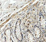 Granzyme B Antibody Human Appendix IHC. Immunohistochemical staining of FFPE human appendix tissue using GZMB Antibody at 2 ug/ml. HIER was performed in pH 8.0 EDTA buffer. An HRP-conjugated goat anti-rabbit IgG secondary antibody with DAB substrate was used for detection. Granzyme B Antibody, a Cytotoxic Lymphocyte Marker Antibody, demonstrates strong granular cytoplasmic staining in scattered lymphoid cells within the appendix, consistent with granzyme B expression in activated cytotoxic T lymphocytes and natural killer cells.