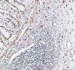 Granzyme B Antibody Human Appendix Lymphoid Tissue IHC. Immunohistochemical staining of FFPE human appendix tissue using GZMB Antibody at 2 ug/ml. HIER was performed in pH 8.0 EDTA buffer. An HRP-conjugated goat anti-rabbit IgG secondary antibody with DAB substrate was used for detection. Granzyme B Antibody, a Cytotoxic Lymphocyte Marker Antibody, demonstrates strong granular cytoplasmic staining in scattered lymphocytes within the appendiceal lymphoid aggregates, consistent with granzyme B expression in activated cytotoxic T lymphocytes and natural killer cells.