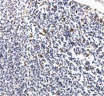 Granzyme B Antibody Human Appendix Immune Cell IHC. Immunohistochemical staining of FFPE human appendix tissue using GZMB Antibody at 2 ug/ml. HIER was performed in pH 8.0 EDTA buffer. An HRP-conjugated goat anti-rabbit IgG secondary antibody with DAB substrate was used for detection. Granzyme B Antibody, a Cytotoxic Lymphocyte Marker Antibody, demonstrates strong granular cytoplasmic staining in scattered immune cells within the appendiceal lymphoid tissue, consistent with granzyme B expression in activated cytotoxic T lymphocytes and natural killer cells.