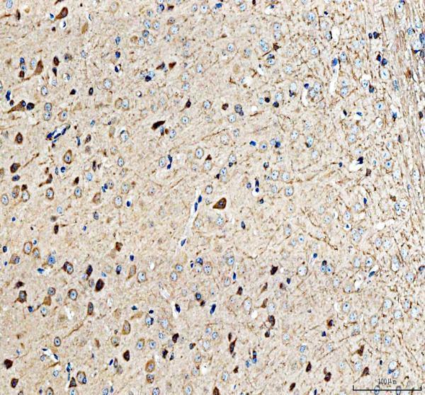 ALK Antibody Mouse Brain IHC. Immunohistochemical staining of FFPE mouse brain tissue with ALK antibody at 2 ug/ml. Heat-induced epitope retrieval (HIER) was performed in pH 8 EDTA buffer prior to staining. ALK immunoreactivity is observed predominantly in neuronal cell bodies and processes, consistent with the expected expression of Anaplastic Lymphoma Kinase (ALK), a receptor tyrosine kinase that regulates neuronal development, cell differentiation, and intracellular signaling pathways. Cell nuclei are counterstained with hematoxylin (blue).