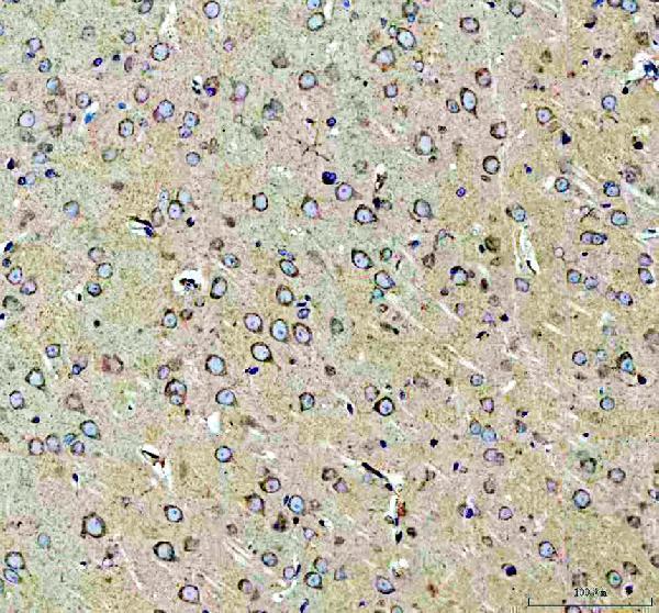 ALK Antibody Rat Brain IHC. Immunohistochemical staining of FFPE rat brain tissue with ALK antibody at 2 ug/ml. Heat-induced epitope retrieval (HIER) was performed in pH 8 EDTA buffer prior to staining. ALK immunoreactivity is observed predominantly in neuronal cell bodies and processes, consistent with the expected expression of Anaplastic Lymphoma Kinase (ALK), a receptor tyrosine kinase that regulates neuronal development, neuronal differentiation, and intracellular signaling pathways. Cell nuclei are counterstained with hematoxylin (blue).