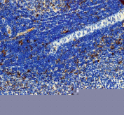 Immunohistochemical staining of FFPE rat spleen tissue with IL-3 antibody, HRP-secondary and DAB substrate. HIER: boil tissue sections in pH8 EDTA for 20 min and allow to cool before testing.