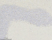 MAG Antibody Rat Cerebellum IHC. Immunohistochemistry was performed on FFPE rat cerebellum tissue using MAG Antibody. Heat-induced epitope retrieval was carried out in pH 8 EDTA buffer prior to antibody incubation. Bound antibody was detected using an HRP-conjugated secondary antibody with DAB chromogen. Strong staining is observed within the cerebellar white matter and myelinated fiber tracts, while the adjacent granular layer shows comparatively weaker immunoreactivity, consistent with the localization of Myelin Associated Glycoprotein to oligodendrocyte myelin sheaths. These results demonstrate that this Axon-Glia Interaction Protein Antibody is suitable for immunohistochemical detection of endogenous MAG in formalin-fixed, paraffin-embedded rat cerebellum tissue.