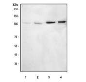 DPYD Antibody Human Mouse Rat WB. Western blot analysis of DPYD expression using a DPYD antibody. Lane 1: human HeLa whole cell lysate. Lane 2: human THP-1 whole cell lysate. Lane 3: rat liver tissue lysate. Lane 4: mouse liver tissue lysate. DPYD, also known as Dihydropyrimidine Dehydrogenase and a Pyrimidine Metabolism Enzyme, catalyzes the rate limiting step in pyrimidine catabolism and is essential for fluoropyrimidine drug metabolism. A distinct band is detected at approximately 111 kDa, corresponding to the expected molecular weight of full length DPYD. Signal intensity is stronger in rat and mouse liver samples, consistent with the prominent role of hepatic tissues in nucleotide turnover and drug metabolism. These results support the utility of DPYD Antibody for studies of pyrimidine metabolism, pharmacogenomics, and metabolic regulation.