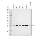 Western blot analysis of DCI Antibody / Dodecenoyl-CoA delta isomerase (ECI1). Proteins were separated by 10% SDS-PAGE and transferred to a nitrocellulose membrane for immunodetection. Lane 1: human COLO320 whole cell lysates; Lane 2: human 293T whole cell lysates; Lane 3: human HeLa whole cell lysates; Lane 4: human MCF-7 whole cell lysates; Lane 5: rat liver tissue lysates; Lane 6: mouse liver tissue lysates. A single predominant band corresponding to ECI1 is detected at approximately 28 kDa across multiple samples. Although the predicted molecular weight of ECI1 based on amino acid sequence is approximately 33 kDa, mitochondrial matrix enzymes such as ECI1 are well documented to migrate at a lower apparent molecular weight on SDS-PAGE. This behavior is commonly attributed to compact protein folding, limited glycosylation, and sequence-specific electrophoretic properties rather than truncation. The observed banding pattern is consistent with published reports of endogenous ECI1 detected in metabolically active tissues.