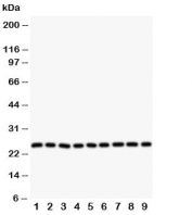 Western blot testing of SOD2 antibody and Lane 1:  rat liver;  2: (r) intestine;  3: (r) lung;  4: (r) heart;  5: human SMMC-7721;  6: (h) HeLa;  7: (h) COLO320;  8: (h) SW620;  9: (h) A549 cell lysate. Predicted molecular weight ~ 25 kDa.