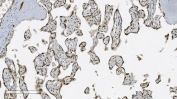 Aryl Hydrocarbon Receptor Antibody Placenta IHC. Immunohistochemical staining of FFPE human placental tissue demonstrates AHR expression using an Aryl Hydrocarbon Receptor antibody. AHR, also known as an Environmental Sensor Protein, is a ligand activated transcription factor that regulates xenobiotic metabolism, immune tolerance, and developmental signaling pathways. Prominent nuclear and cytoplasmic staining is observed in trophoblastic cells lining the chorionic villi, consistent with the established role of AHR in placental development and maintenance of the maternal fetal interface. Heat induced epitope retrieval was performed by boiling tissue sections in pH 8 EDTA buffer for 20 minutes followed by cooling prior to staining. These results support the utility of AHR Antibody for studies of reproductive biology, developmental signaling, and environmental response mechanisms.
