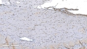 Aryl Hydrocarbon Receptor Antibody Mouse Brain IHC. Immunohistochemical staining of FFPE mouse brain tissue demonstrates AHR expression using an Aryl Hydrocarbon Receptor antibody. AHR, also known as an Environmental Sensor Protein, is a ligand activated transcription factor that integrates signals from dietary metabolites, microbiota derived compounds, and environmental ligands to regulate neurodevelopment and immune homeostasis. Scattered nuclear and cytoplasmic staining is observed in neuronal and glial populations, with increased reactivity in cells adjacent to the ventricular surface, consistent with the emerging role of AHR in central nervous system function and neuroinflammatory signaling. Heat induced epitope retrieval was performed by boiling tissue sections in pH 8 EDTA buffer for 20 minutes followed by cooling prior to staining. These results support the utility of AHR Antibody for studies of neurobiology, environmental sensing, and transcriptional regulation.