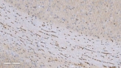 Aryl Hydrocarbon Receptor Antibody Cerebellum IHC. Immunohistochemical staining of FFPE mouse brain tissue demonstrates AHR expression using an Aryl Hydrocarbon Receptor antibody. AHR, also known as an Environmental Sensor Protein, is a ligand activated transcription factor that regulates responses to endogenous metabolites and environmental stimuli. Distinct nuclear staining is observed in linear arrays of cells within the cerebellar white matter and adjacent neuronal layers, consistent with the expression of AHR in specialized neural and glial populations involved in maintaining central nervous system homeostasis. Heat induced epitope retrieval was performed by boiling tissue sections in pH 8 EDTA buffer for 20 minutes followed by cooling prior to staining. These findings support the utility of AHR Antibody for investigations of neurodevelopment, neuroinflammation, and transcriptional responses to environmental cues.