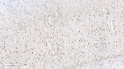Aryl Hydrocarbon Receptor Antibody Rat Brain IHC. Immunohistochemical staining of FFPE rat brain tissue demonstrates AHR expression using an Aryl Hydrocarbon Receptor antibody. AHR, also known as an Environmental Sensor Protein, is a ligand activated transcription factor that integrates signals from endogenous metabolites, dietary compounds, and environmental toxicants to regulate gene expression and immune responses. Widespread nuclear staining is observed throughout neuronal populations and scattered glial cells, reflecting the role of AHR in maintaining neural homeostasis and modulating neuroinflammatory pathways. Heat induced epitope retrieval was performed by boiling tissue sections in pH 8 EDTA buffer for 20 minutes followed by cooling prior to staining. These results support the utility of AHR Antibody for studies of neurobiology, transcriptional regulation, and environmental sensing mechanisms.