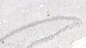 Aryl Hydrocarbon Receptor Antibody Hippocampus IHC. Immunohistochemical staining of FFPE rat brain tissue demonstrates AHR expression using an Aryl Hydrocarbon Receptor antibody. AHR, also known as an Environmental Sensor Protein, is a ligand activated transcription factor that regulates xenobiotic responses, immune signaling, and neuronal homeostasis. Prominent nuclear staining is observed within densely packed neuronal layers of the hippocampal formation, while scattered positive cells are present throughout the surrounding parenchyma. This distribution is consistent with emerging roles for AHR in neurodevelopment, synaptic plasticity, and responses to endogenous metabolic cues. Heat induced epitope retrieval was performed by boiling tissue sections in pH 8 EDTA buffer for 20 minutes followed by cooling prior to staining. These findings support the utility of AHR Antibody for studies of neurobiology, environmental sensing, and transcriptional regulation.