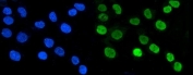 Aryl Hydrocarbon Receptor Antibody A431 Cells IF. Immunofluorescent staining of FFPE human A431 cells demonstrates AHR expression using an Aryl Hydrocarbon Receptor antibody (green). AHR, also known as an Environmental Sensor Protein, is a ligand activated transcription factor that translocates to the nucleus following activation by endogenous metabolites and xenobiotic ligands. Strong nuclear fluorescence is observed, consistent with the role of AHR in regulating transcriptional responses and cellular adaptation to environmental stimuli. DAPI nuclear stain identifies cell nuclei (blue). Heat induced epitope retrieval was performed by steaming sections in pH 6 citrate buffer for 20 minutes prior to staining. These results support the utility of AHR Antibody for studies of toxicology, signal transduction, and transcriptional regulation.