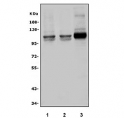 Aryl Hydrocarbon Receptor Antibody Human Cell Lines WB. Western blot analysis of AHR expression using an Aryl Hydrocarbon Receptor antibody. Lane 1: human HeLa cell lysate. Lane 2: human PC-3 cell lysate. Lane 3: human Caco-2 cell lysate. AHR, also known as an Environmental Sensor Protein, is a ligand activated transcription factor that regulates xenobiotic metabolism and cellular responses to endogenous and environmental ligands. A prominent band is detected at approximately 95 kDa in all three cell lines, corresponding to the expected molecular weight of full length AHR. Stronger expression is observed in Caco-2 cells, consistent with the important role of AHR in intestinal barrier function and metabolic signaling. These results support the utility of AHR Antibody for studies of toxicology, immune regulation, and signal transduction.
