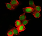 MCM7 Antibody Rabbit Polyclonal - immunofluorescence staining of human MCF7 cells. FFPE human MCF7 cells were stained with MCM7 Antibody Rabbit Polyclonal to detect Minichromosome maintenance protein 7 / MCM7 (green). Nuclear fluorescence is observed in many cells, consistent with the known nuclear localization of this DNA replication licensing factor in proliferating cells. Alpha Tubulin monoclonal antibody staining highlights the cytoskeletal microtubule network (red), providing cellular context for the nuclear MCM7 signal. Heat-induced epitope retrieval was performed by steaming sections in pH6 citrate buffer for 20 minutes prior to staining.