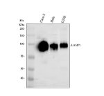 LAMP1 Antibody Human Epithelial Cell WB. Western blot analysis of human cell lysates using LAMP1 Antibody / Lysosomal Membrane Glycoprotein Antibody. Lane 1: human Caco-2 cells; Lane 2: human HeLa cells; Lane 3: human U2OS cells. A broad immunoreactive band is detected at approximately 95-120 kDa in all three cell lines. Although the predicted molecular weight of the LAMP1 polypeptide is approximately 45 kDa, extensive N-linked glycosylation substantially increases its apparent molecular weight, and LAMP1 is routinely observed between approximately 95 and 120 kDa. This LAMP1 Antibody is suitable for investigating lysosomal membrane biology, intracellular trafficking, autophagy, and lysosome-associated cellular processes.