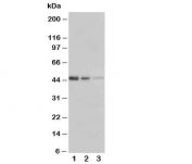 Western blot testing of ERBB3 antibody and Lane 1:  Recombinant human protein 5ng;  2: 2.5ng;  3: 1.25ng