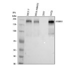 ERBB3 Antibody Human Breast Cancer Cell WB. Western blot analysis was performed using ERBB3 Antibody on lane 1: human MCF-7, lane 2: human MDA-MB453, lane 3: human 293T, and lane 4: human T-47D whole cell lysates. A prominent immunoreactive band is detected at approximately 180 kDa in MCF-7, MDA-MB453, and T-47D cells, while little to no ERBB3 expression is observed in 293T cells. The detected band is consistent with the heavily glycosylated mature ERBB3 receptor commonly observed at a higher apparent molecular weight than its predicted size. This ERBB3 Antibody / EGFR Family Receptor Antibody is well suited for Western blot studies of EGFR family signaling, receptor dimerization, neuregulin-mediated activation, and cancer biology.