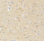 CSF1R Antibody IHC in Human Brain. Immunohistochemistry of FFPE human brain tissue was performed with CSF1R Antibody at 2 ug/ml following heat-induced epitope retrieval in pH 8 EDTA buffer. Brown staining is present in a population of scattered cells within the brain tissue, with predominantly cytoplasmic and membranous labeling. The staining supports tissue detection using an M-CSF Receptor Antibody.