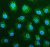 Immunofluorescent staining of FFPE human A549 cells with MALT1 antibody (green) and DAPI nuclear stain (blue). HIER: steam section in pH6 citrate buffer for 20 min.