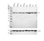 NOX4 Antibody Human Cell Line WB. Western blot analysis was performed using NOX4 Antibody. Lane 1: human BEAS-2B whole cell lysate; lane 2: human BEAS-2B whole cell lysate; lane 3: human U2OS whole cell lysate; lane 4: human SH-SY5Y whole cell lysate; lane 5: human HeLa whole cell lysate; lane 6: human HepG2 whole cell lysate; lane 7: human PC-3 whole cell lysate; lane 8: human A549 whole cell lysate. Proteins were separated on a 10% SDS-PAGE gel, transferred to a nitrocellulose membrane, and incubated with the primary antibody at 0.5 ug/ml overnight at 4Â°C. A specific immunoreactive band is detected at approximately 67 kDa in all tested cell lines, consistent with the expected molecular weight of NOX4. These results demonstrate that this Reactive Oxygen Species Enzyme Antibody is suitable for Western blot detection of NOX4 across multiple human cell lines.