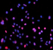 Immunofluorescent staining of FFPE human Caco-2 cells with Nucleophosmin antibody (red) and DAPI nuclear stain (blue). HIER: steam section in pH6 citrate buffer for 20 min.
