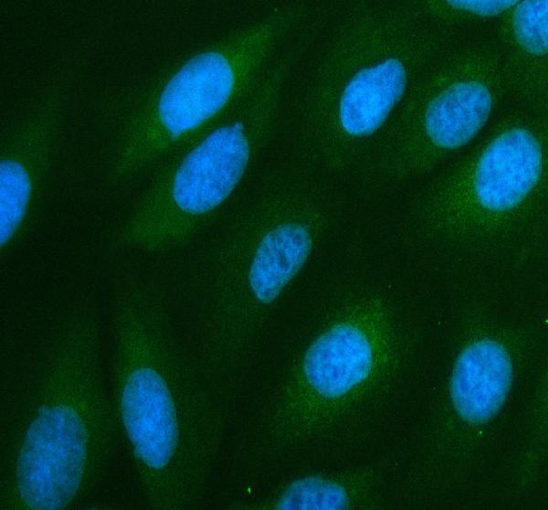 NOX5 Antibody Human U-2 OS Cell IF. Immunofluorescent staining of human U-2 OS cells with NOX5 / NADPH Oxidase 5 antibody (green) at 5 ug/ml. Enzyme-mediated antigen retrieval was performed for 15 minutes prior to staining. Nuclei are counterstained with DAPI (blue). NOX5 immunoreactivity is observed predominantly within the cytoplasm with a diffuse distribution throughout the cells, consistent with the expected intracellular localization of this NADPH oxidase family member.