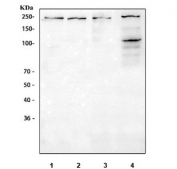 Western blot testing of 1) rat brain, 2) rat C6, 3) mouse brain and 4) mouse NIH 3T3 cell lysate with VEGFR1 antibody. Predicted molecular weight ~150 kDa but may be observed at higher molecular weights due to glycosylation.